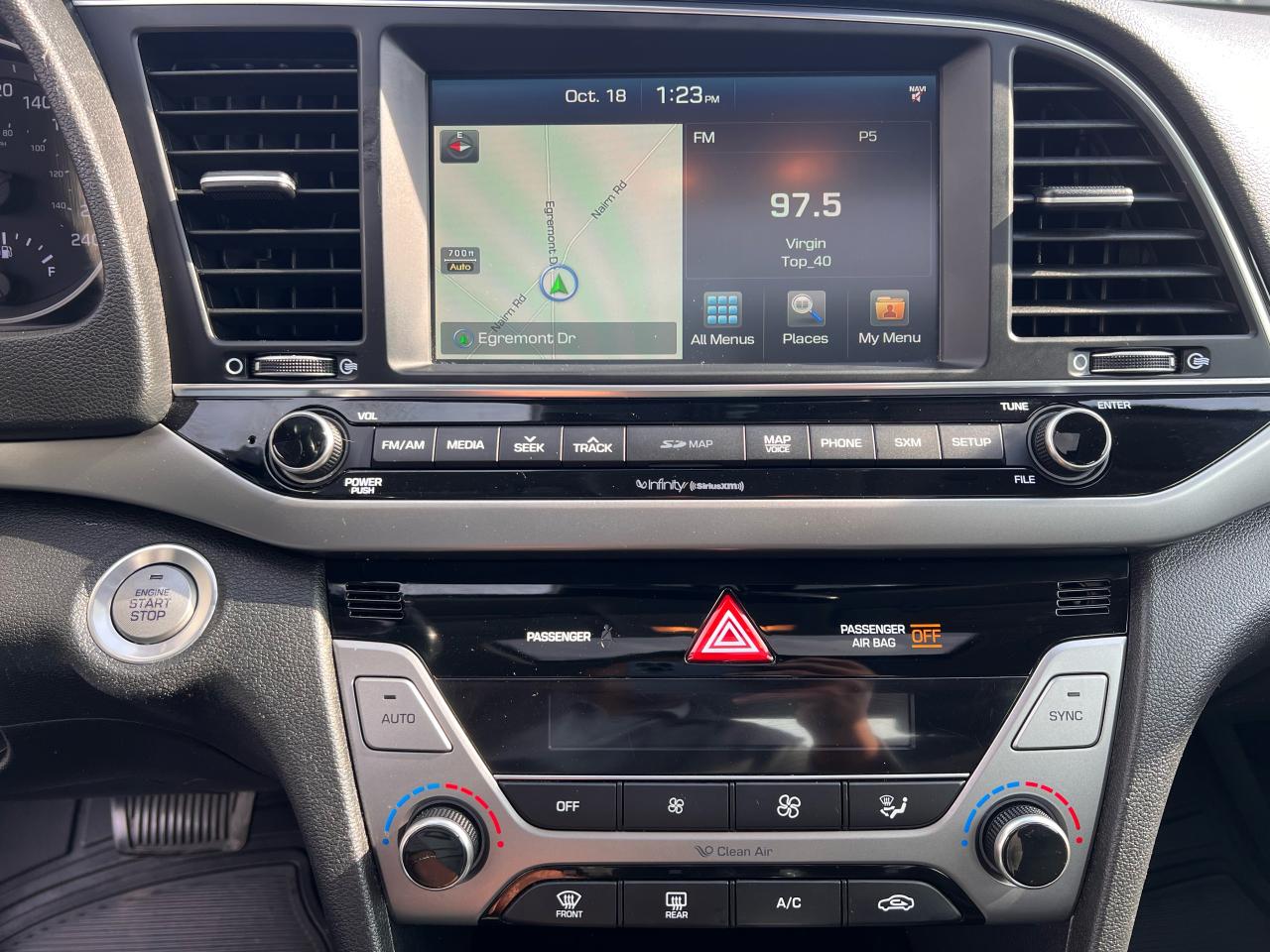 2018 Hyundai Elantra Limited Photo51