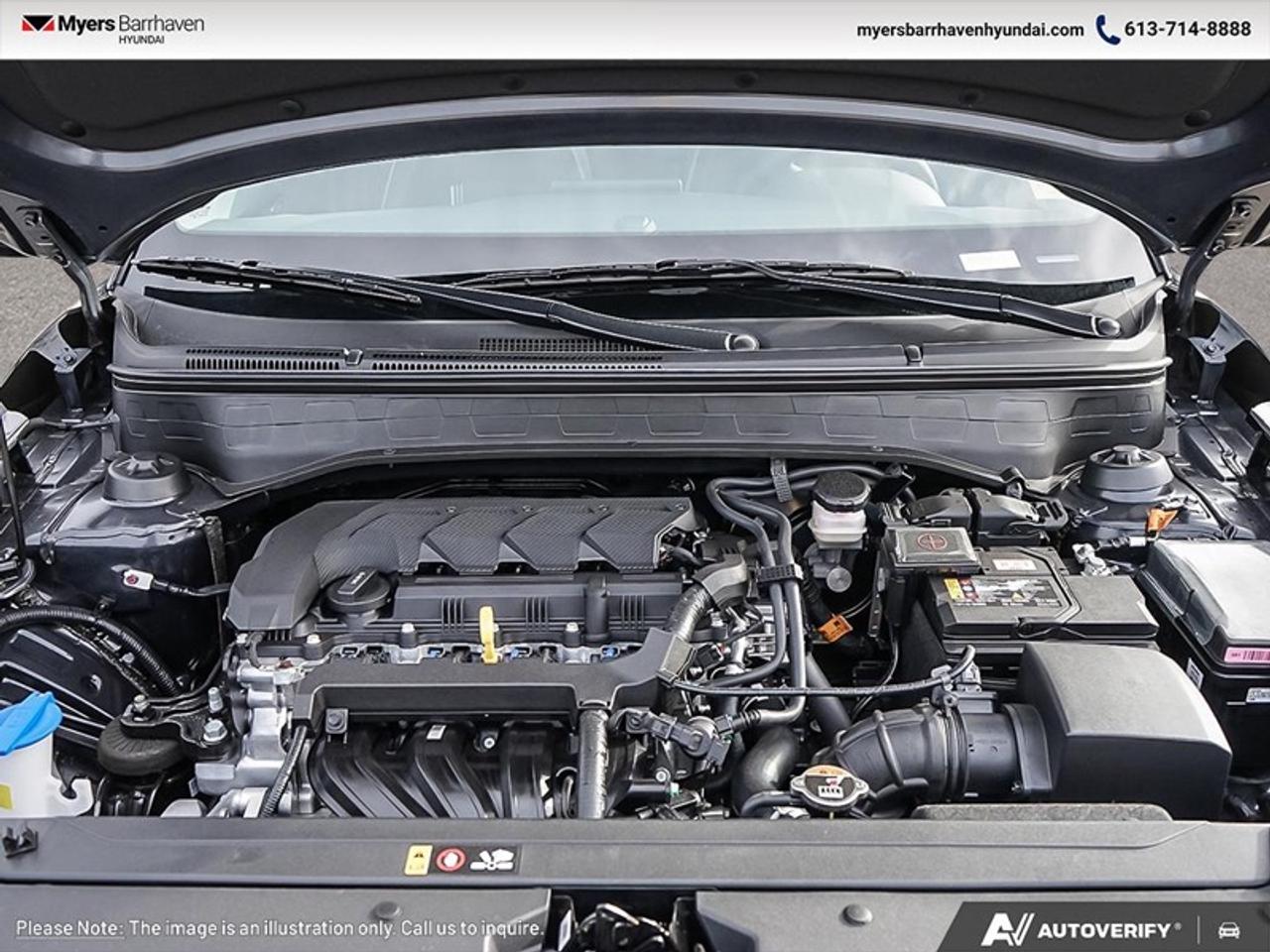 2026 Hyundai Venue Ultimate IVT  - Sunroof -  Heated Seats Photo