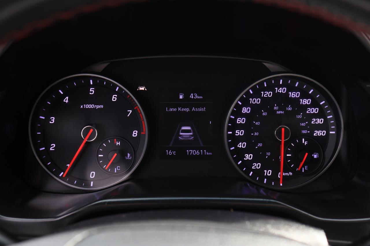 2020 Hyundai Elantra Sport | 6 Speed | Leather | Roof | CarPlay & More! Photo62