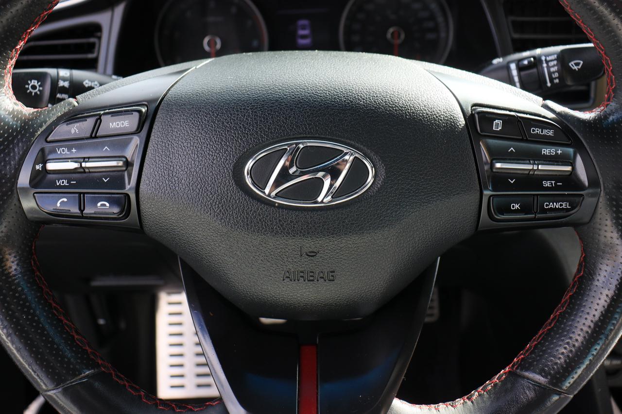 2020 Hyundai Elantra Sport | 6 Speed | Leather | Roof | CarPlay & More! Photo61