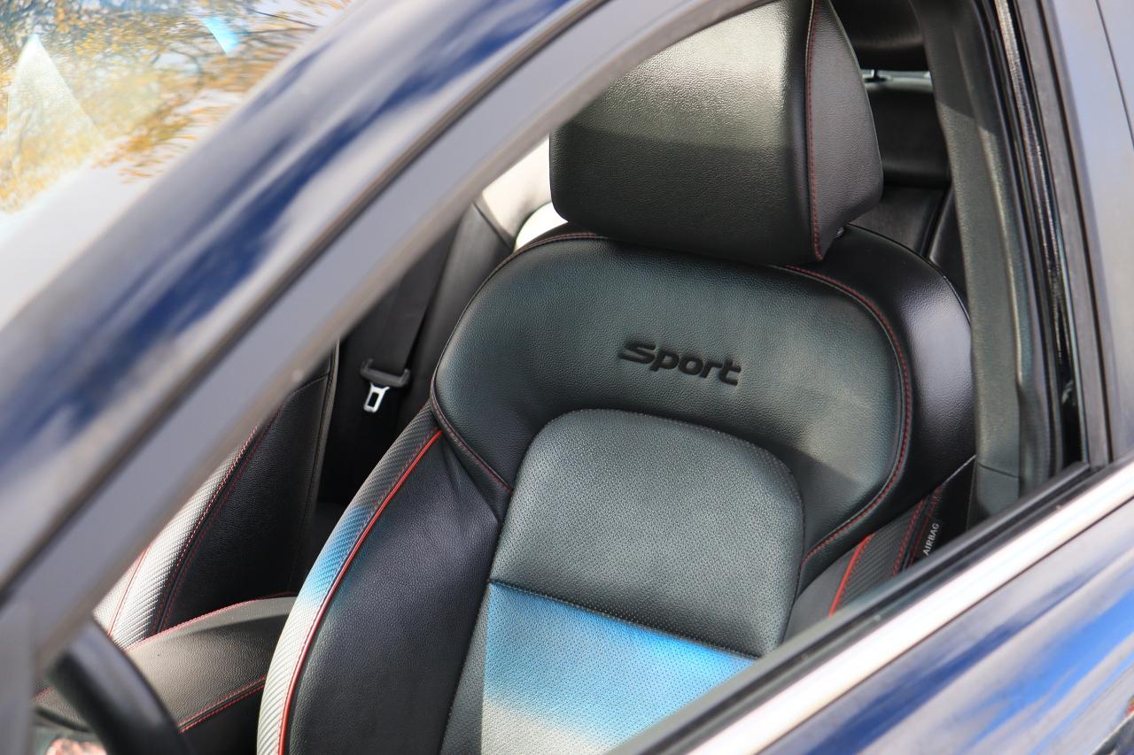 2020 Hyundai Elantra Sport | 6 Speed | Leather | Roof | CarPlay & More! Photo18