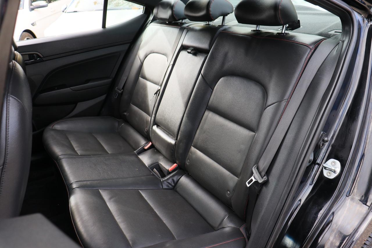 2020 Hyundai Elantra Sport | 6 Speed | Leather | Roof | CarPlay & More! Photo69