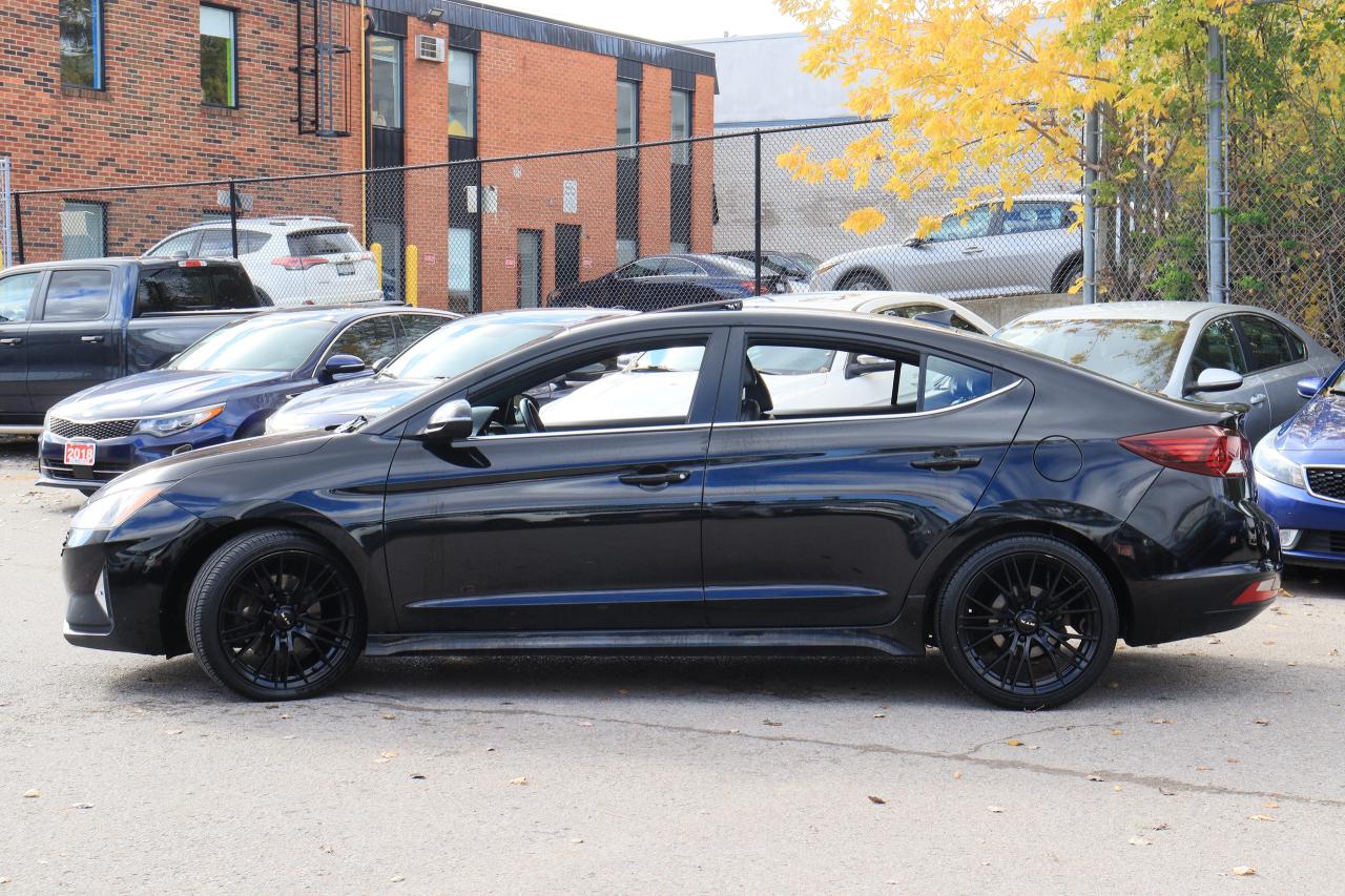 2020 Hyundai Elantra Sport | 6 Speed | Leather | Roof | CarPlay & More! Photo6