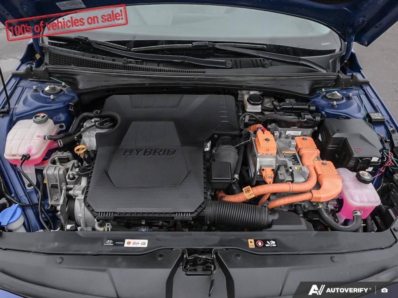 2021 Hyundai Elantra Ultimate Photo