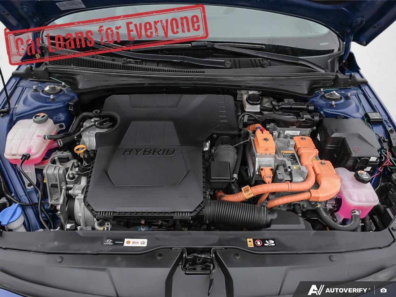 2021 Hyundai Elantra Ultimate Photo