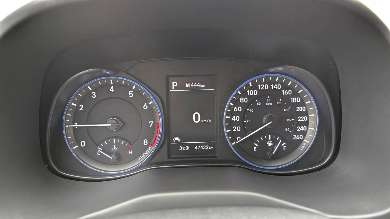 2020 Hyundai KONA 1.6T Ultimate AWD w/Red Colour Pack Photo