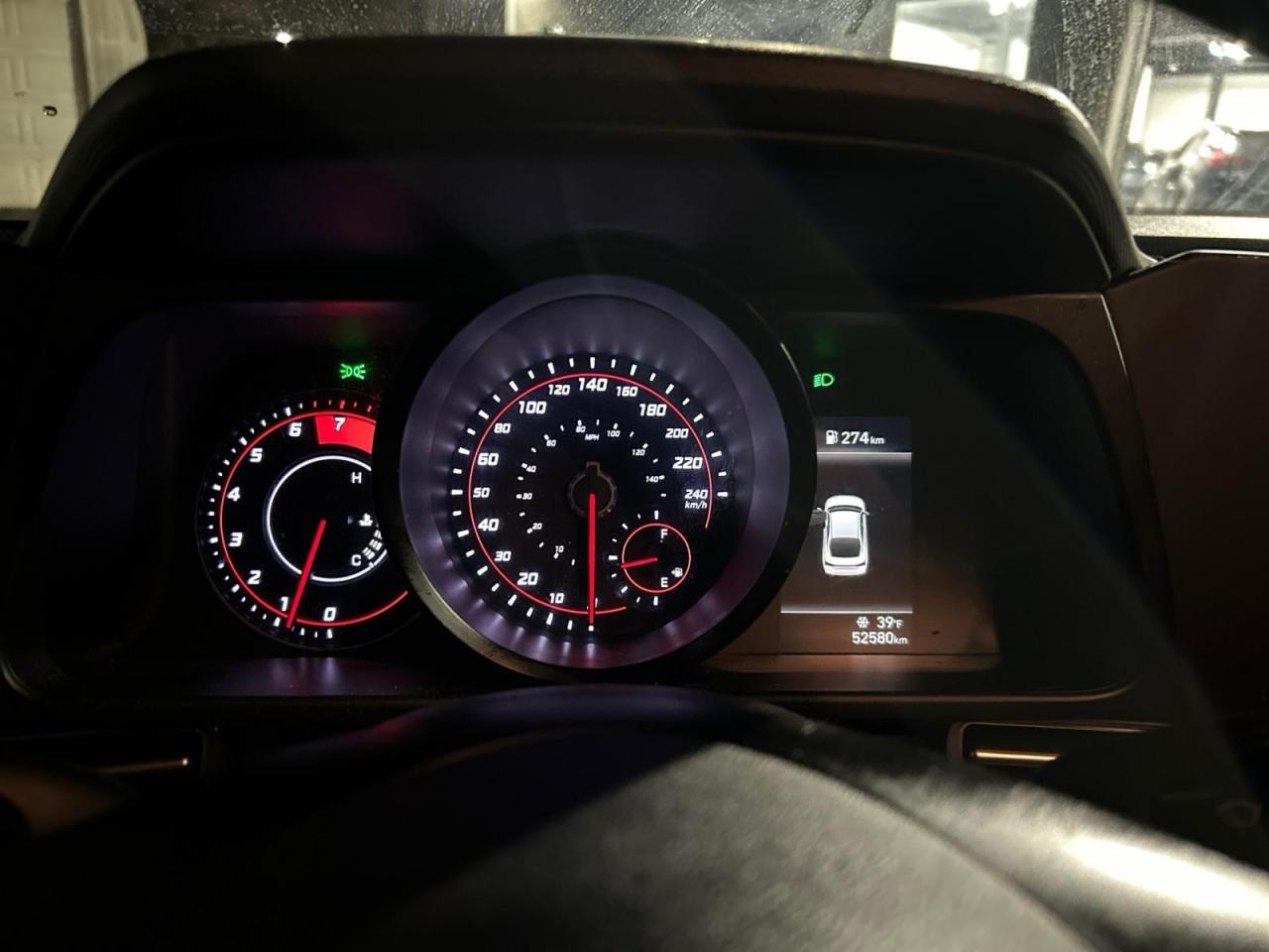 2021 Hyundai Elantra Ultimate Photo