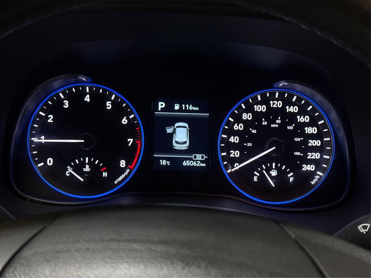 2020 Hyundai KONA Luxury LEATHER SUNROOF MINT WE FINANCE ALL CREDIT! Photo