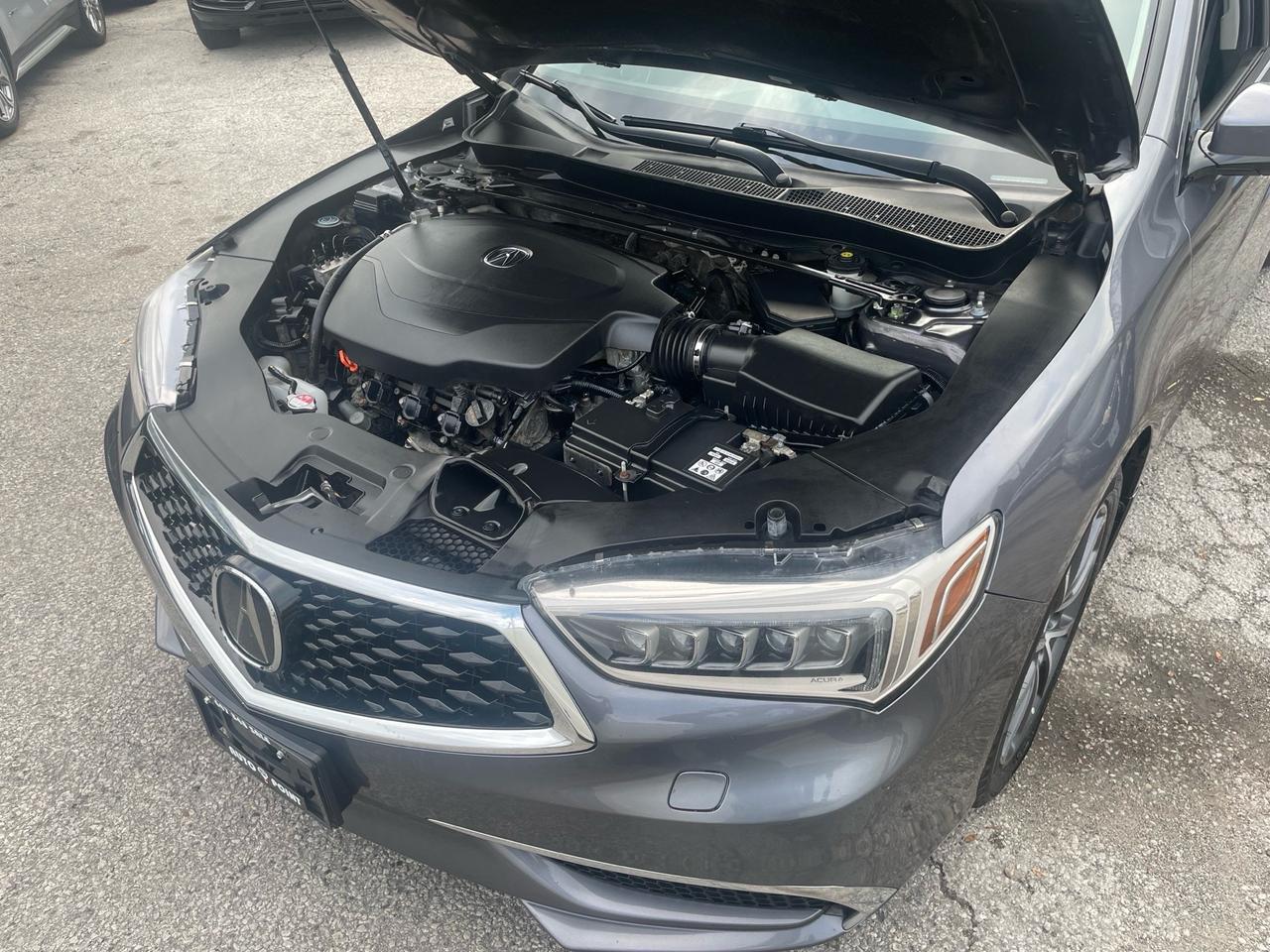 2018 Acura TLX SH-AWD Sedan Photo