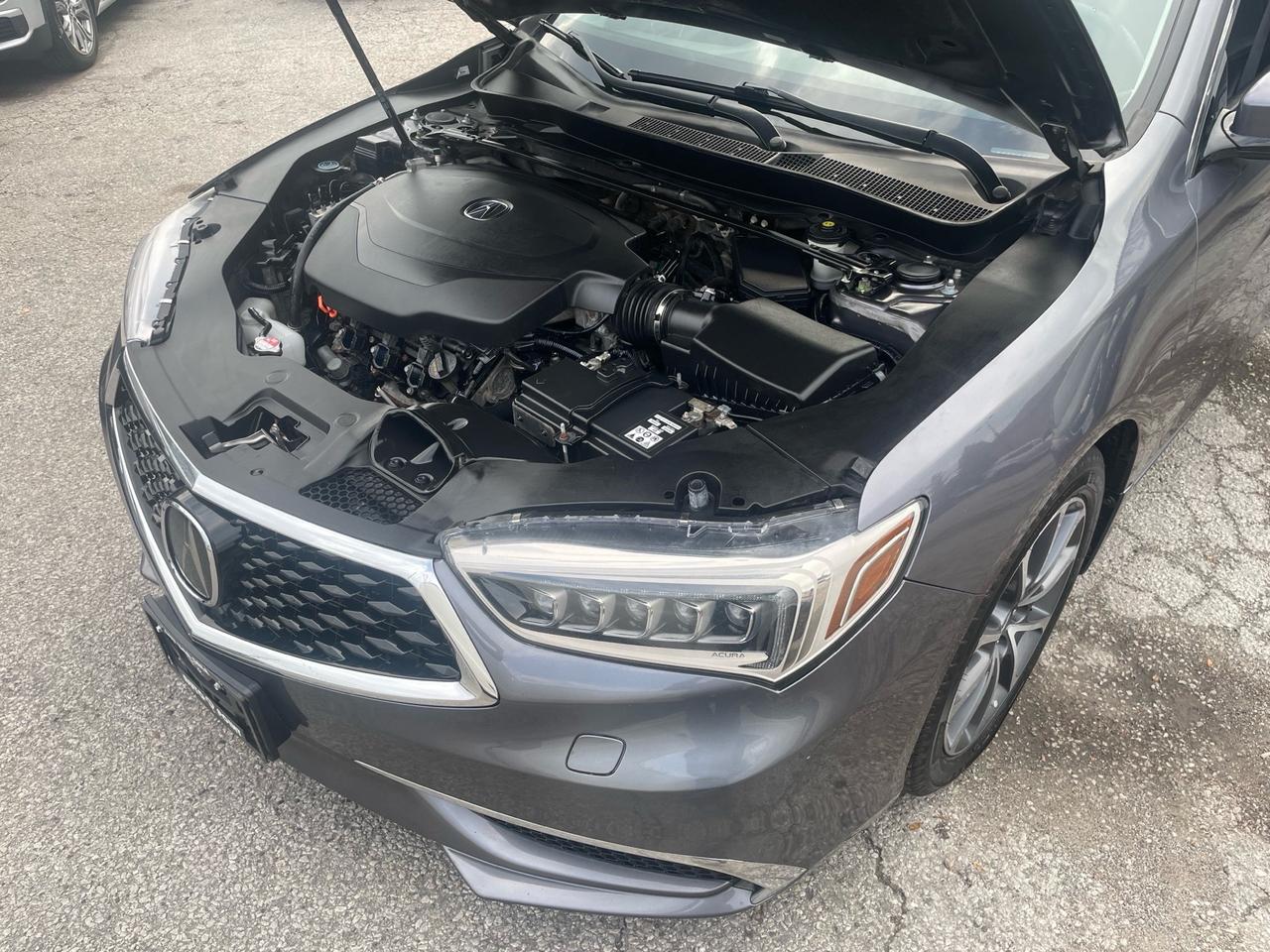 2018 Acura TLX SH-AWD Sedan Photo