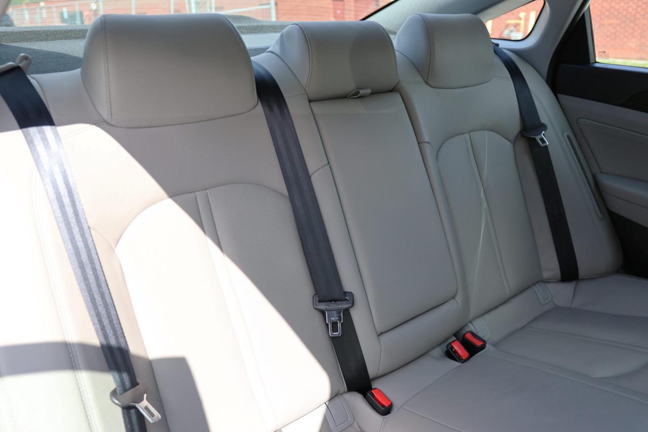 2017 Hyundai Sonata ULTIMATE/NAV/LEATHER/B CAM/CARPLAY/PUSH START/BLIS Photo