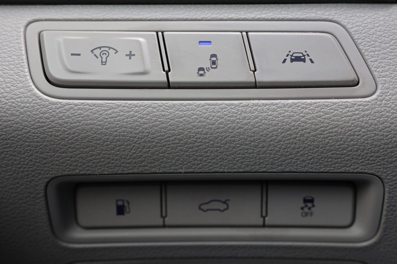 2017 Hyundai Sonata ULTIMATE/NAV/LEATHER/B CAM/CARPLAY/PUSH START/BLIS Photo