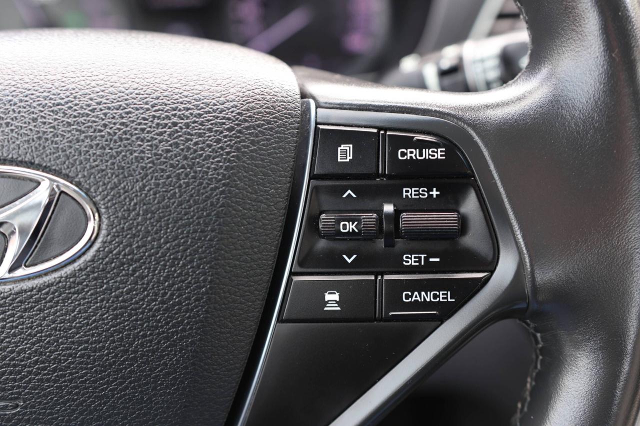 2017 Hyundai Sonata ULTIMATE/NAV/LEATHER/B CAM/CARPLAY/PUSH START/BLIS Photo