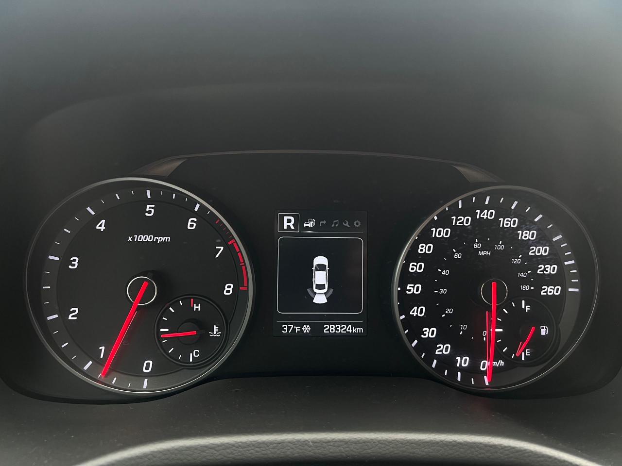 2017 Hyundai Elantra Sport Tech NO ACCIDENTS HEATED SEATS & STEERING Photo