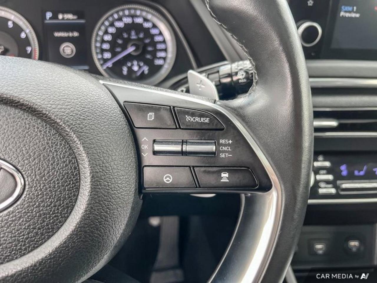 2021 Hyundai Sonata Luxury 1.6T | Leather | Sunroof | Nav | 360 Camera | Bose | Cooled + Heated Seats | and More ! Photo