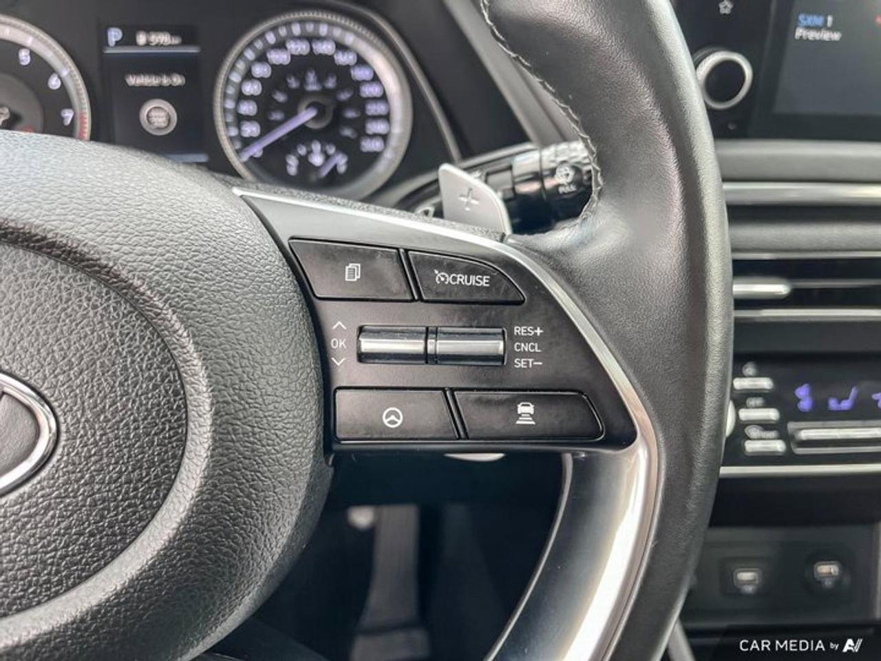 2021 Hyundai Sonata Luxury 1.6T | Leather | Sunroof | Nav | 360 Camera | Bose | Cooled + Heated Seats | and More ! Photo