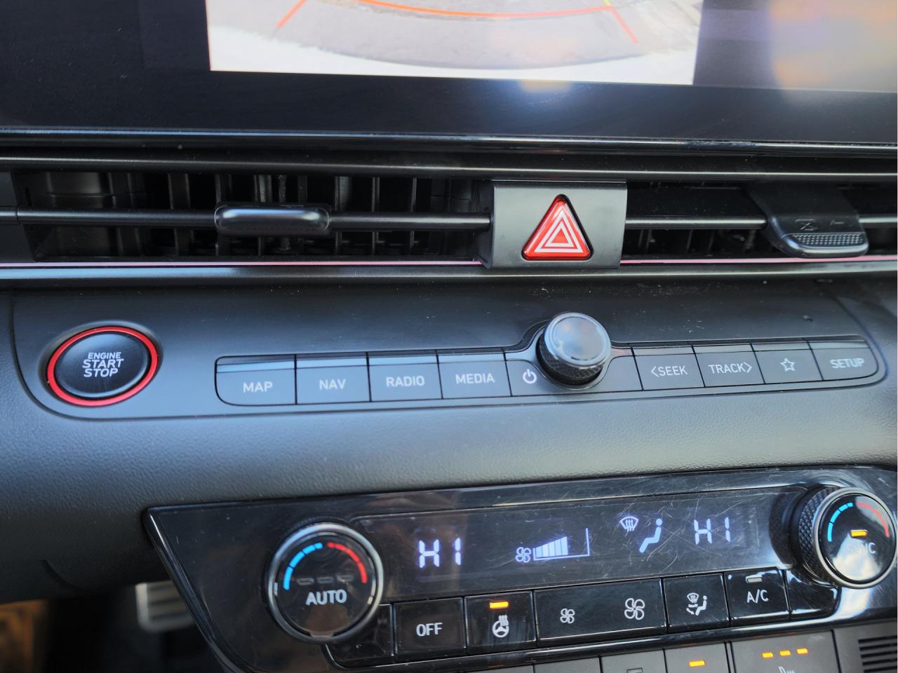 2025 Hyundai Elantra N Line Ultimate   Turbo   Bose Audio   Sunroof Photo