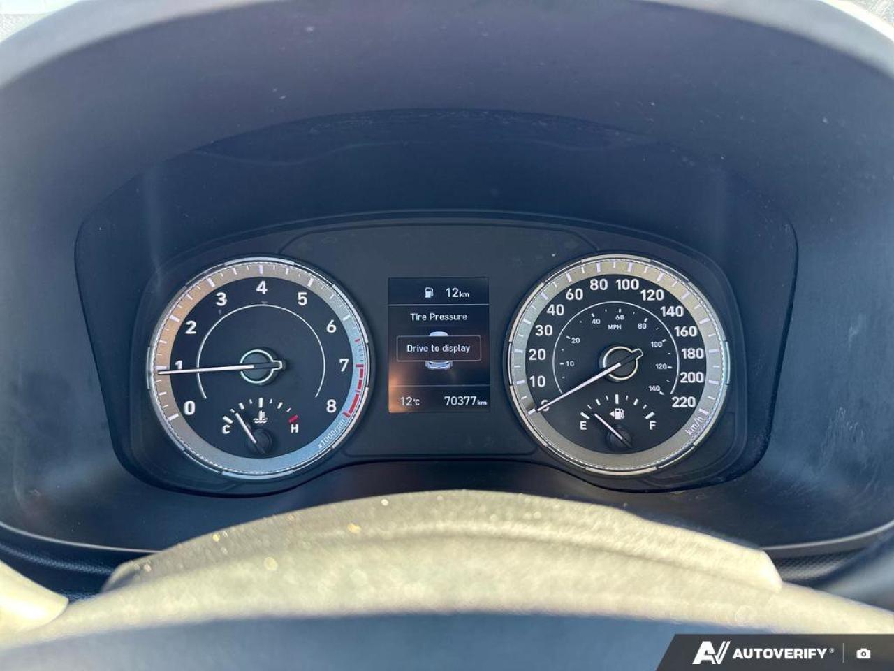 2021 Hyundai Venue Essential   6-Speed Manual   Heated Seats   Carpla Photo