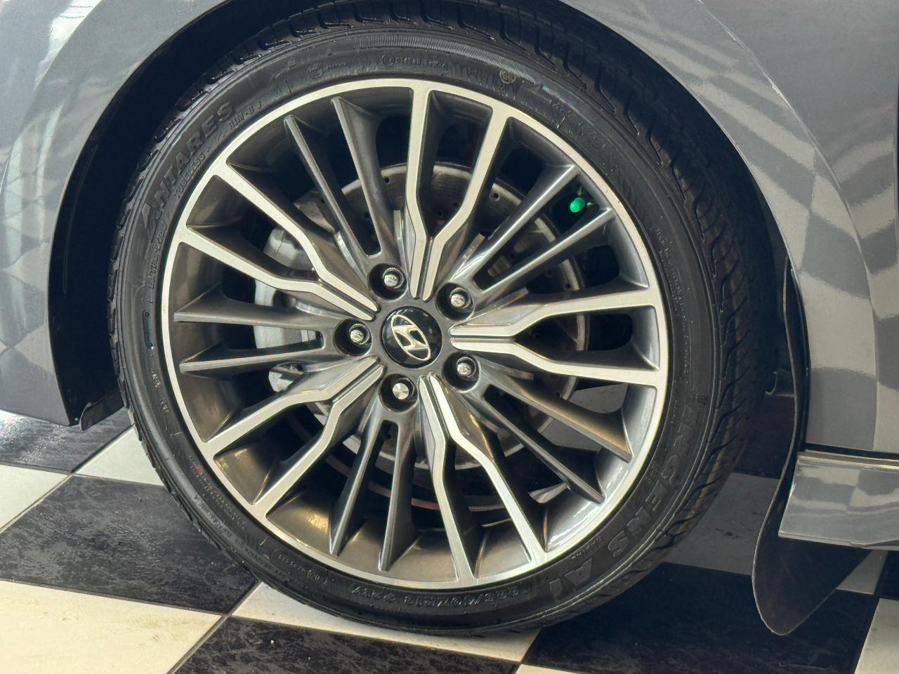 2017 Hyundai Elantra SPORT Turbo DCT+CAM+Roof+Leather+ACCIDENT FREE Photo