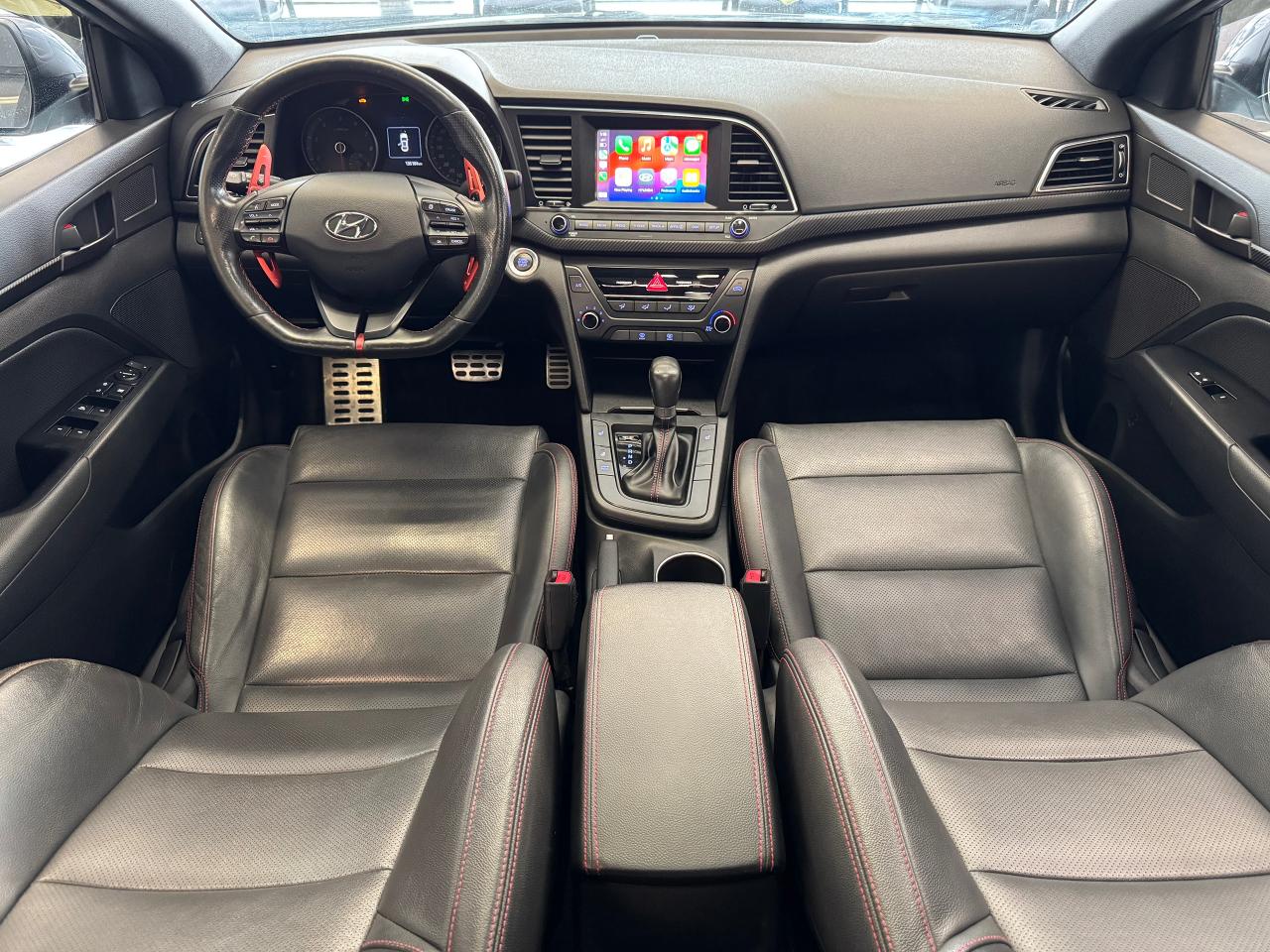 2017 Hyundai Elantra SPORT Turbo DCT+CAM+Roof+Leather+ACCIDENT FREE Photo