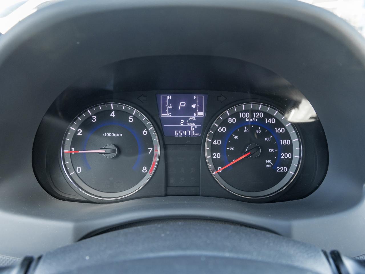 2017 Hyundai Accent AS IS - 4dr Sdn Auto SE Photo