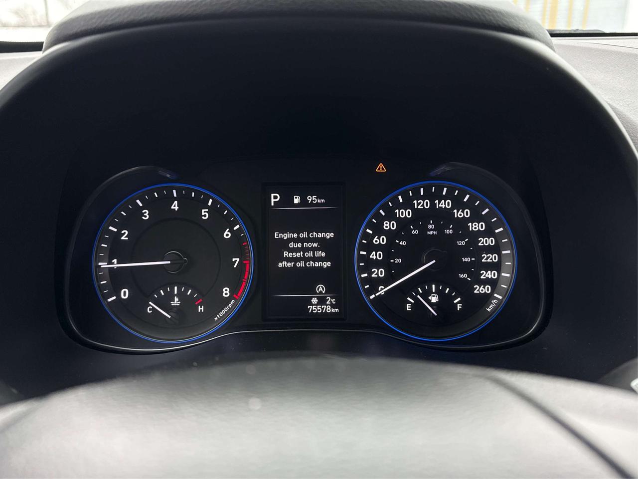 2023 Hyundai KONA AWD HEATED SEATS MINT WE FINANCE ALL CREDIT! Photo