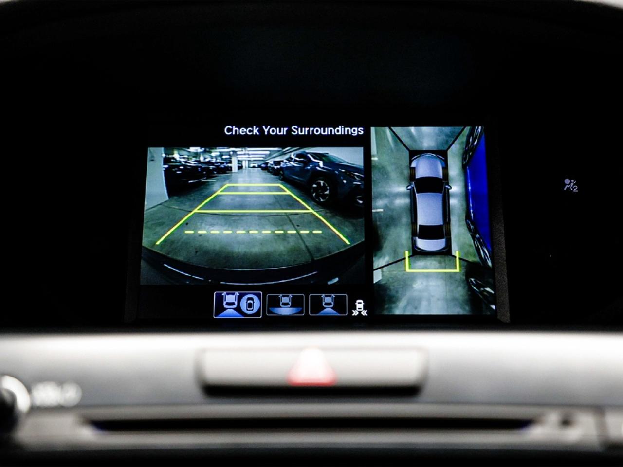 2018 Acura TLX  Photo