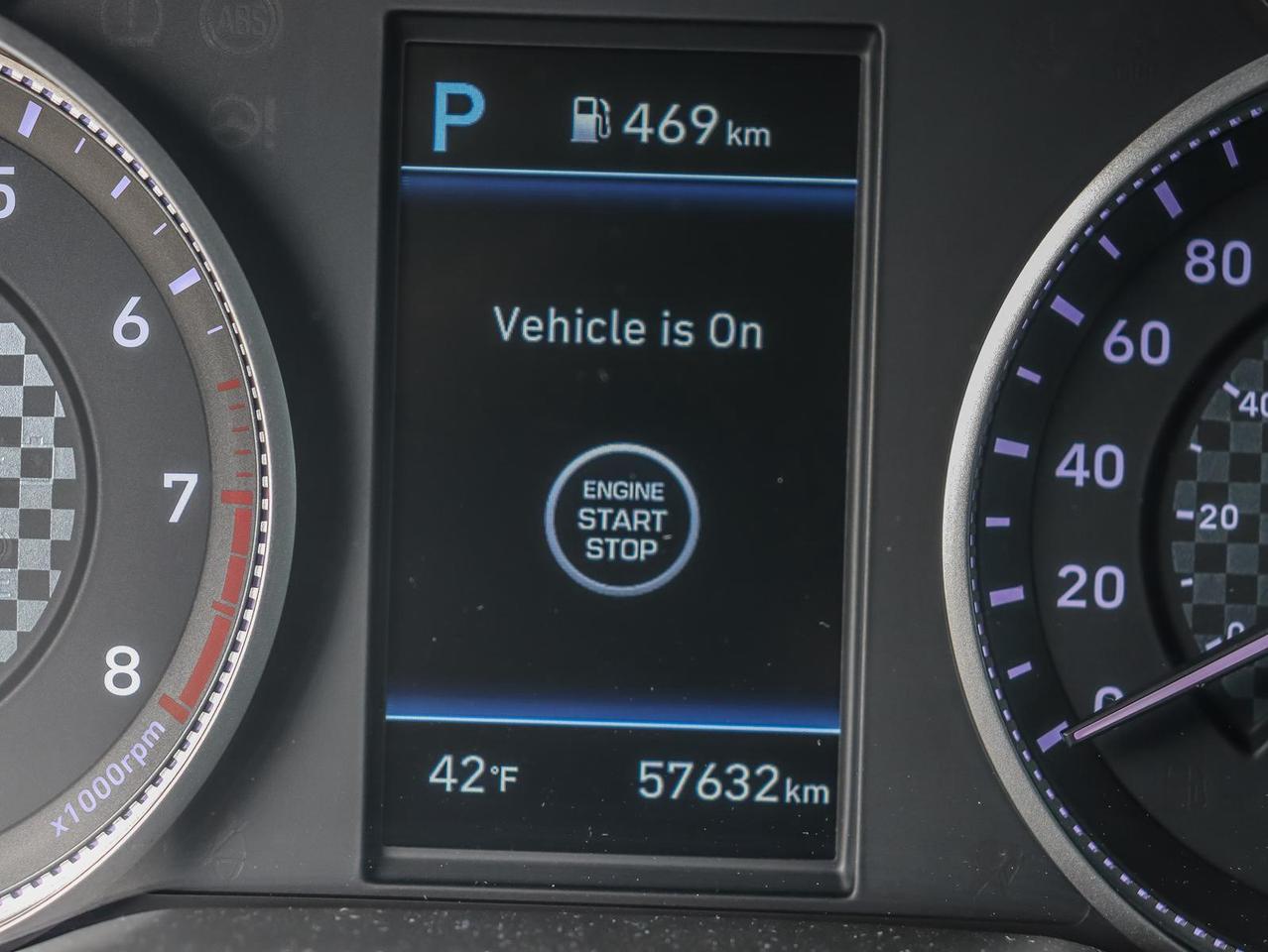2020 Hyundai Elantra Ultimate 4dr Sedan Photo