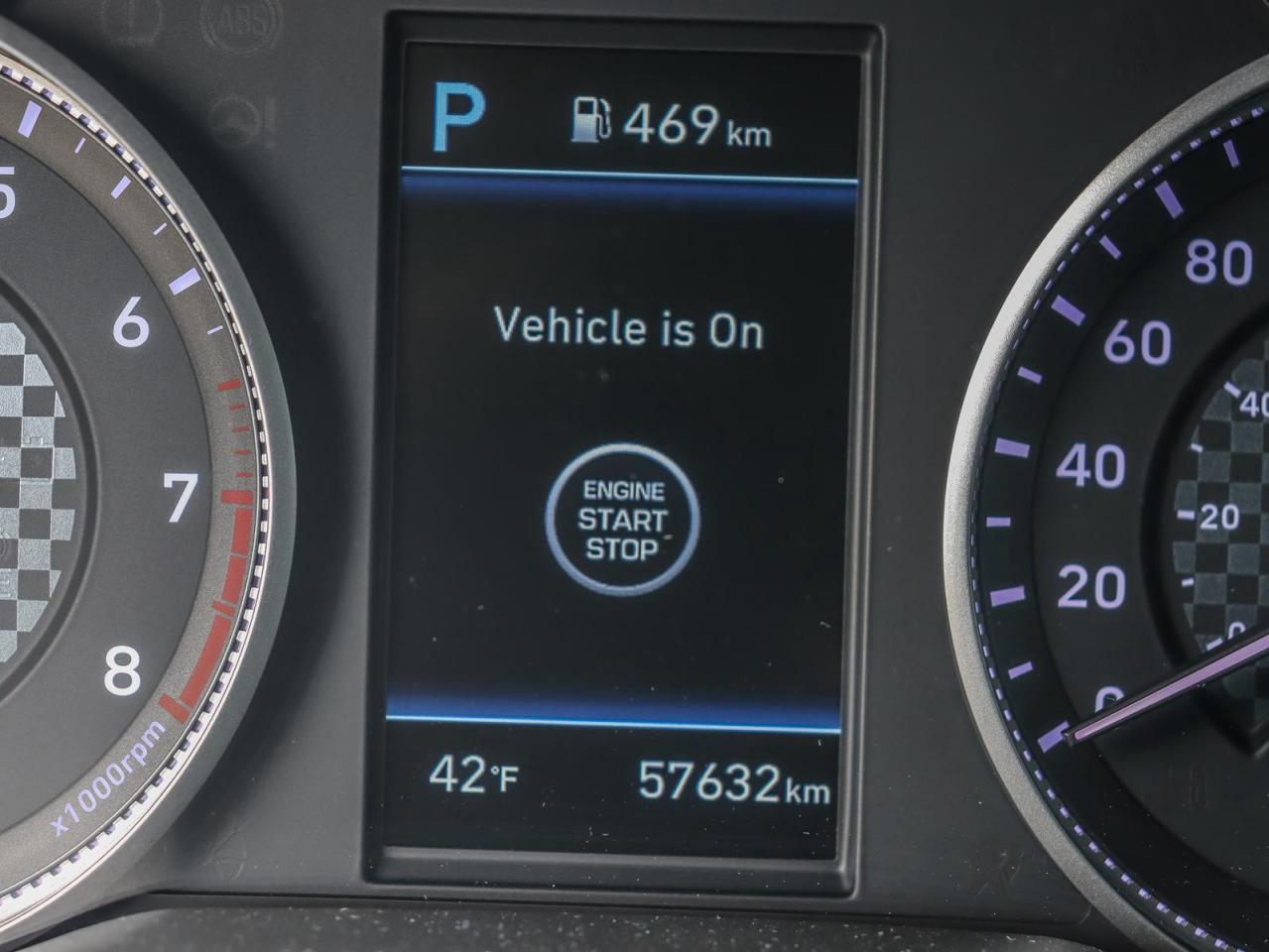 2020 Hyundai Elantra Ultimate 4dr Sedan Photo