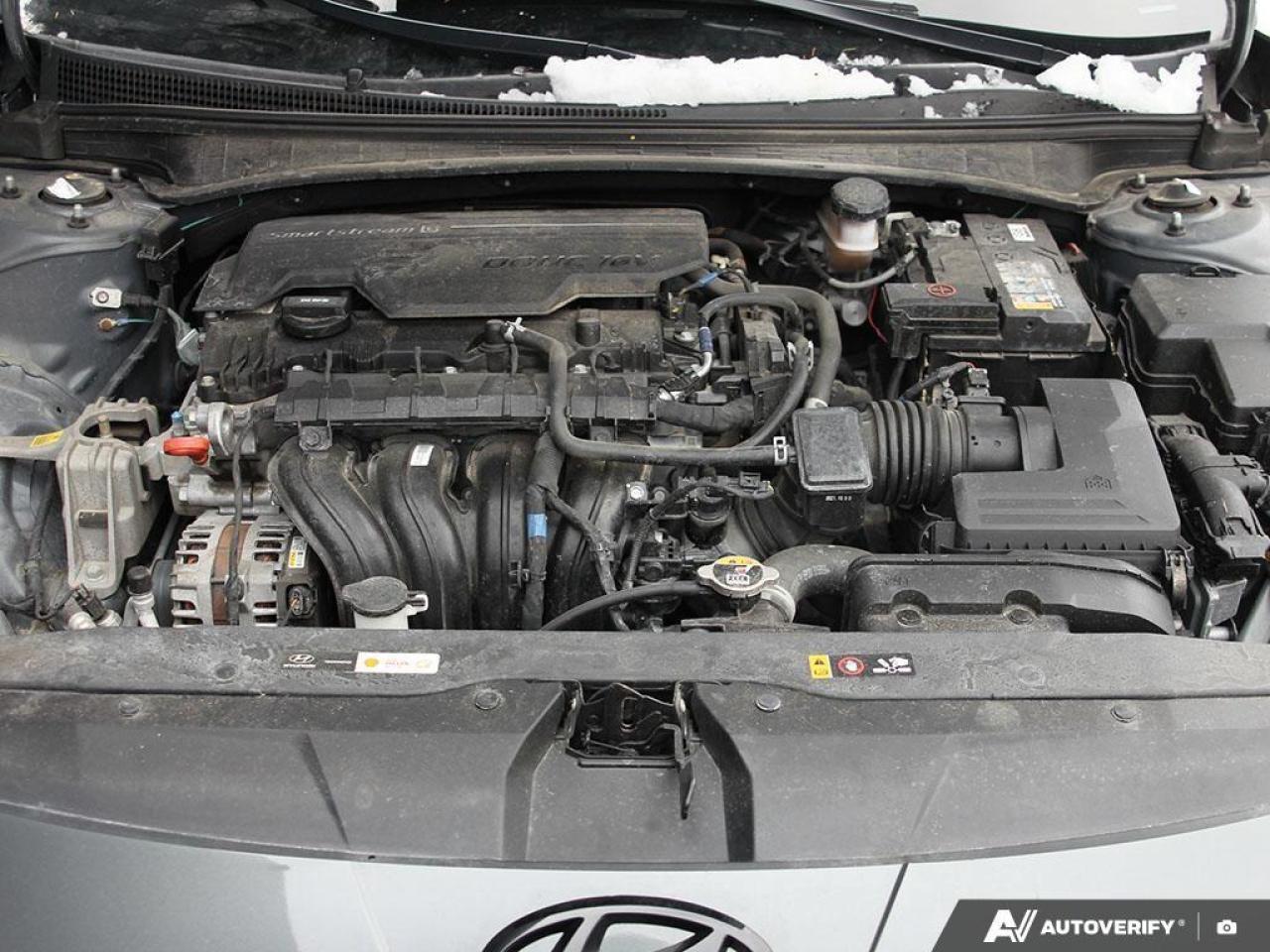 2022 Hyundai Elantra Ultimate 4dr Sedan Photo