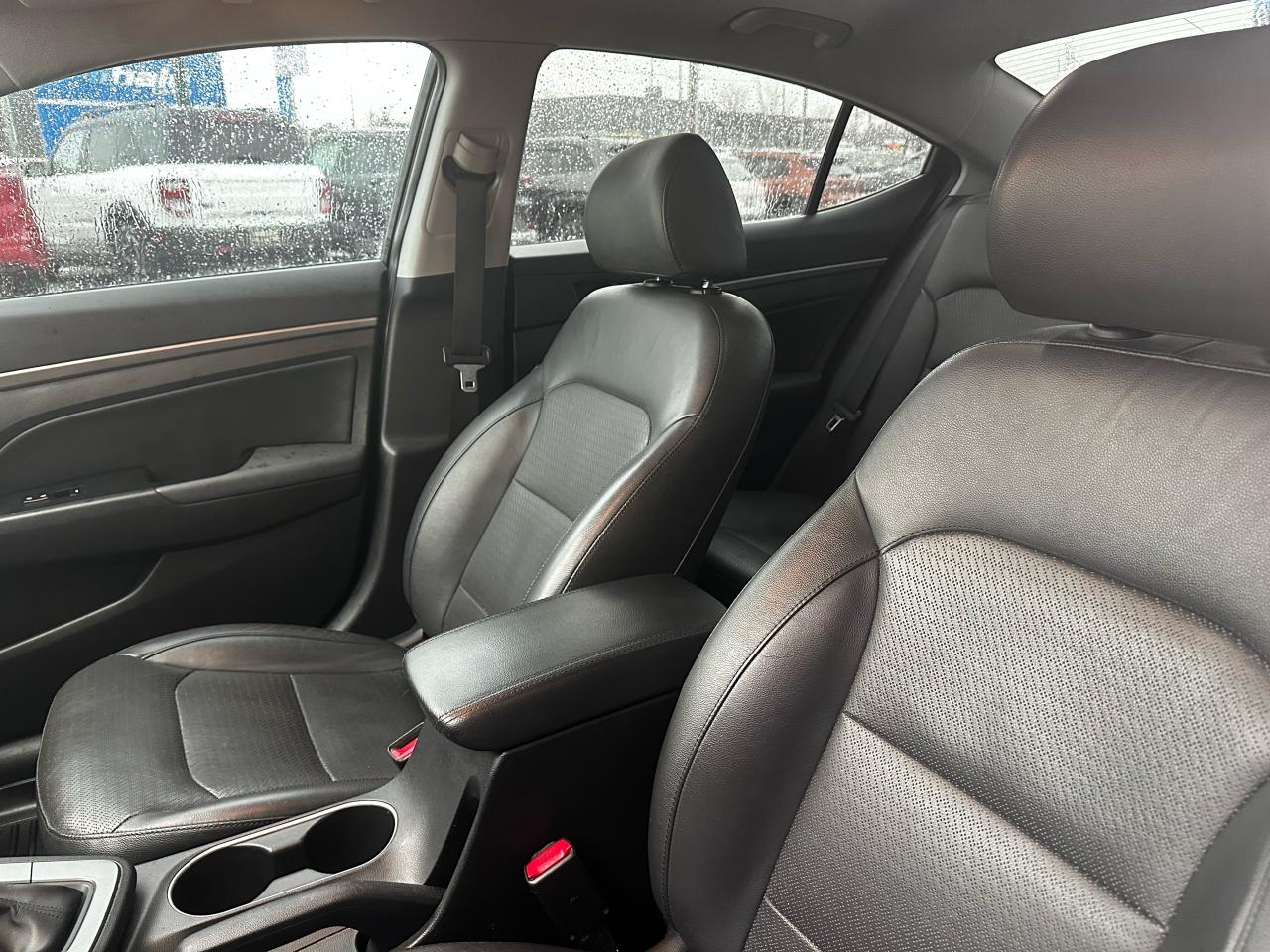 2017 Hyundai Elantra Limited ULTIMATE Photo