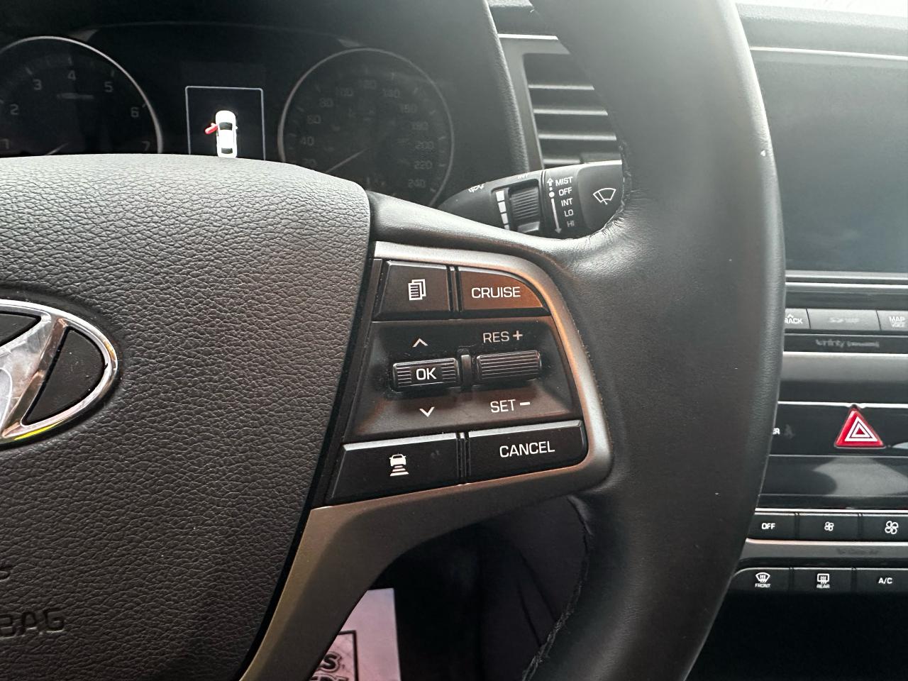 2017 Hyundai Elantra Limited ULTIMATE Photo