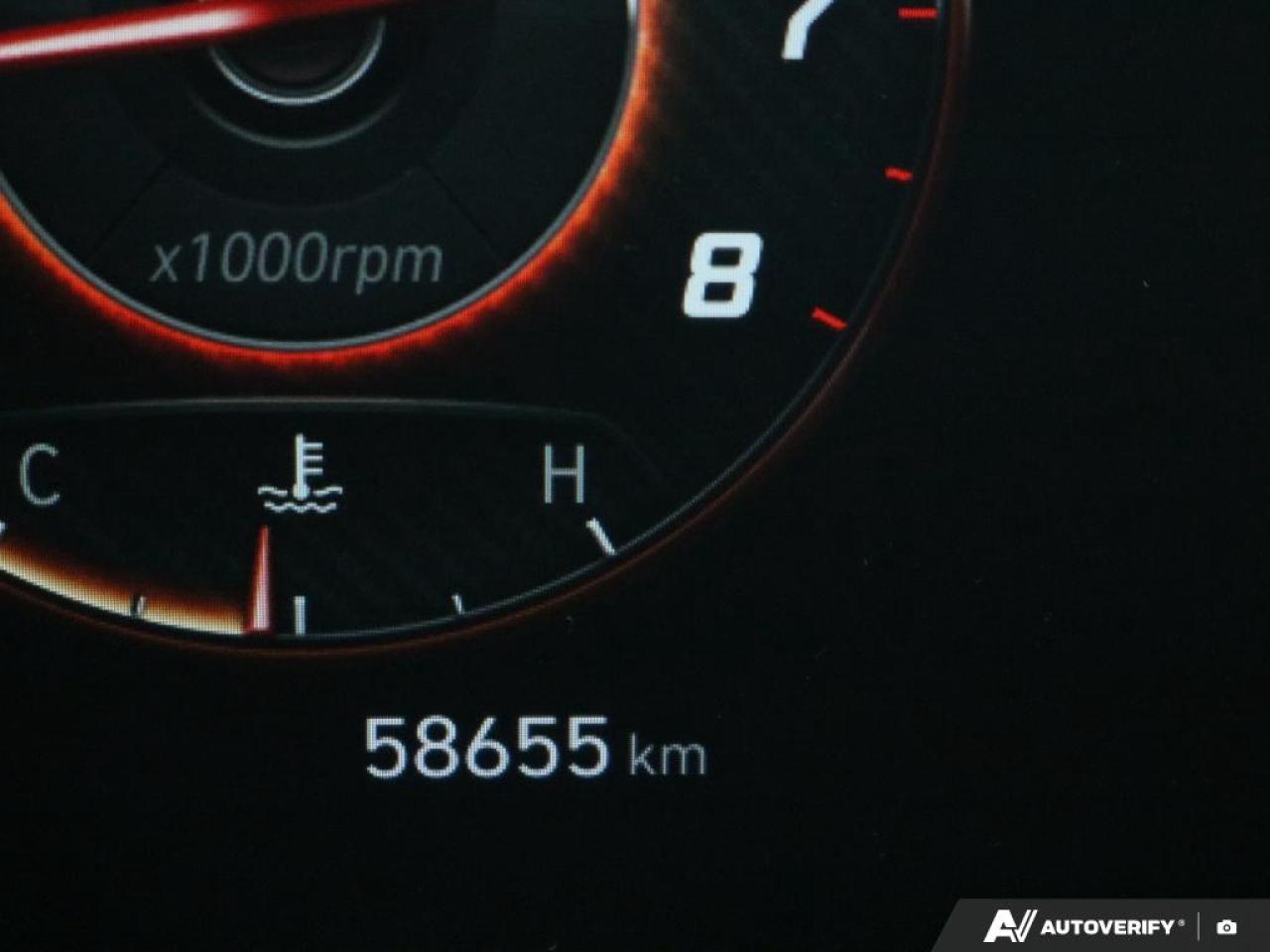 2021 Hyundai Elantra Ultimate Tech Photo