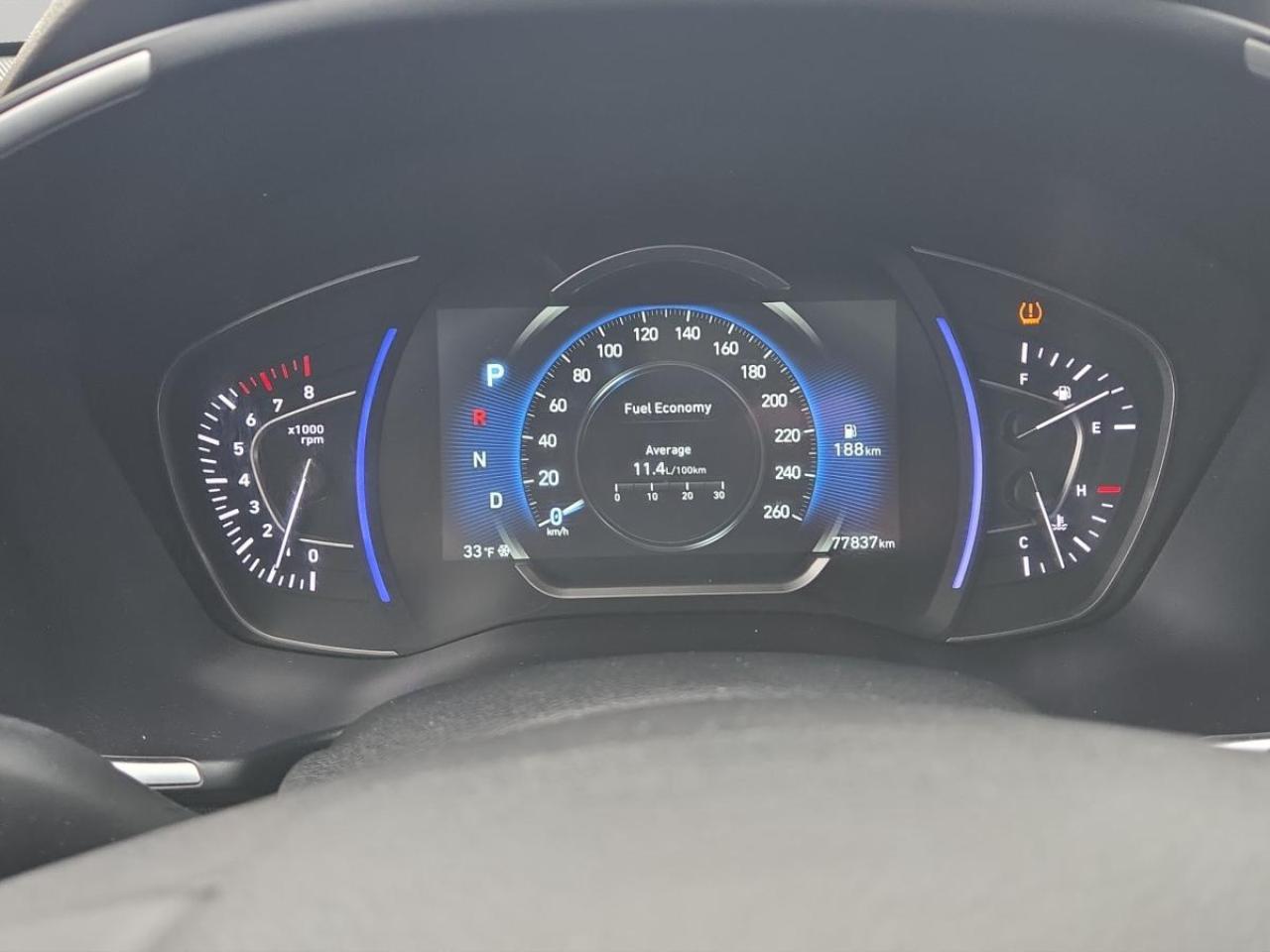 2020 Hyundai Santa Fe Ultimate Photo