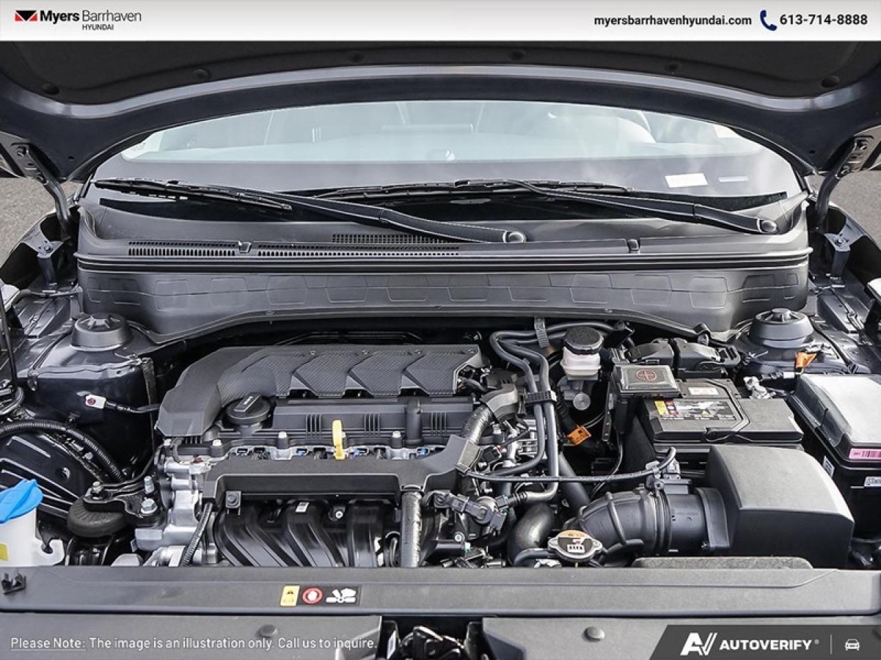 2026 Hyundai Venue Ultimate IVT  - Sunroof -  Heated Seats Photo