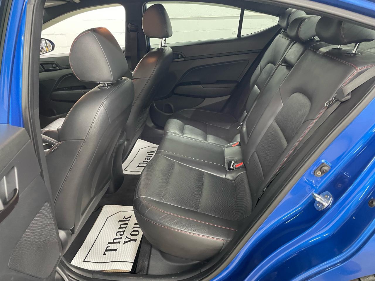 2018 Hyundai Elantra Sport Photo9