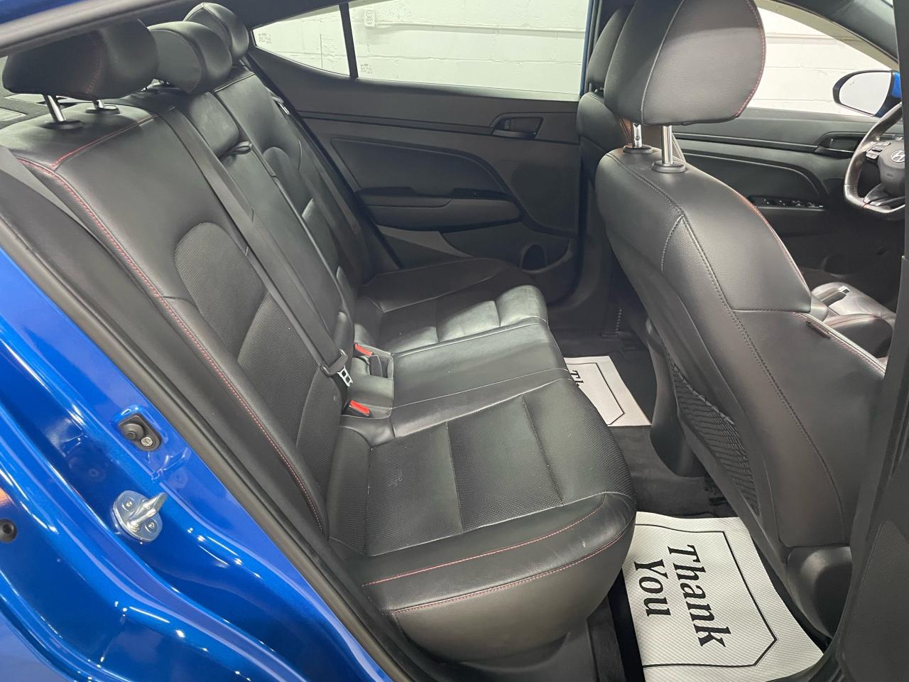 2018 Hyundai Elantra Sport Photo10