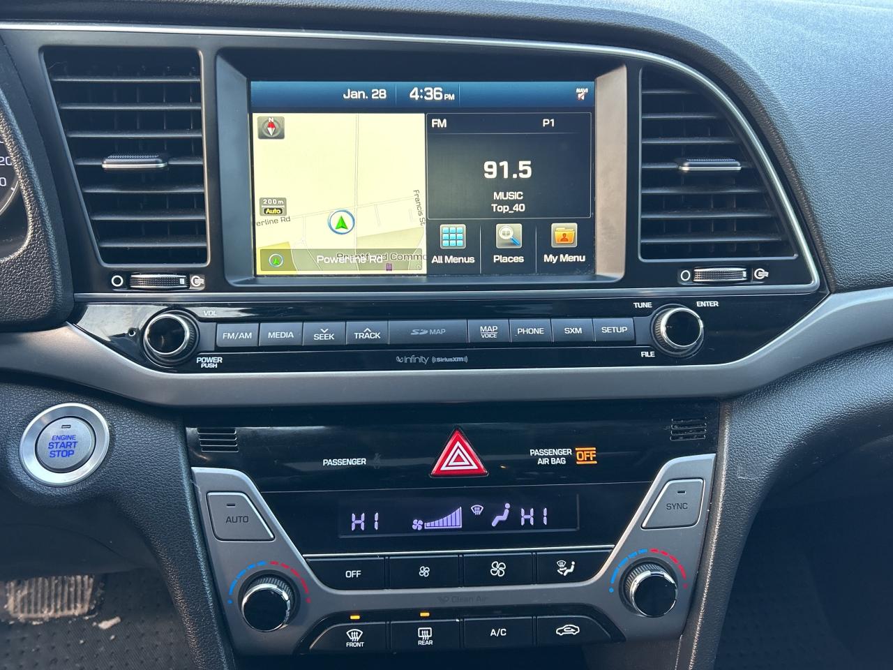 2017 Hyundai Elantra Limited Photo