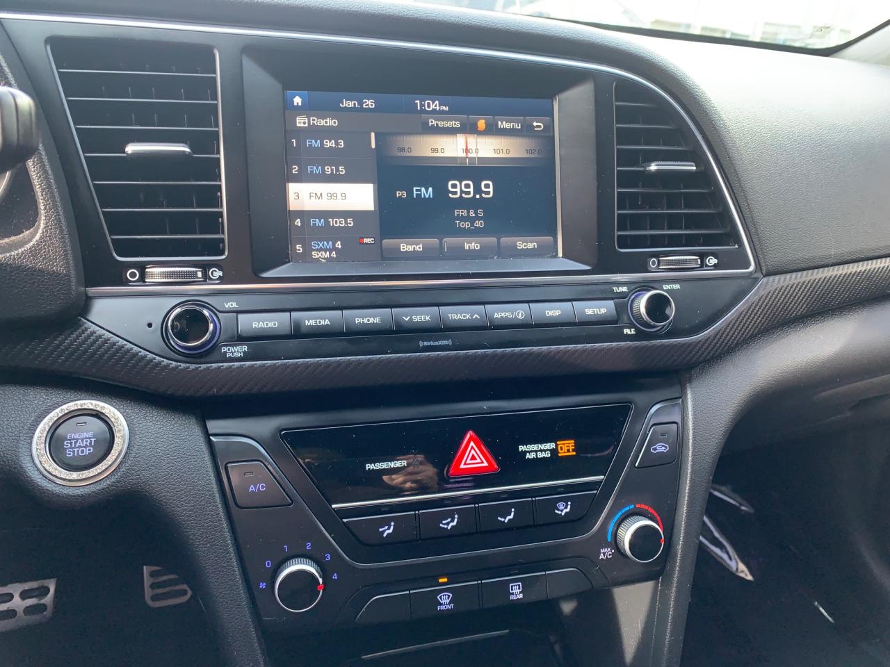 2017 Hyundai Elantra Sport (DCT) 4dr Sedan Photo