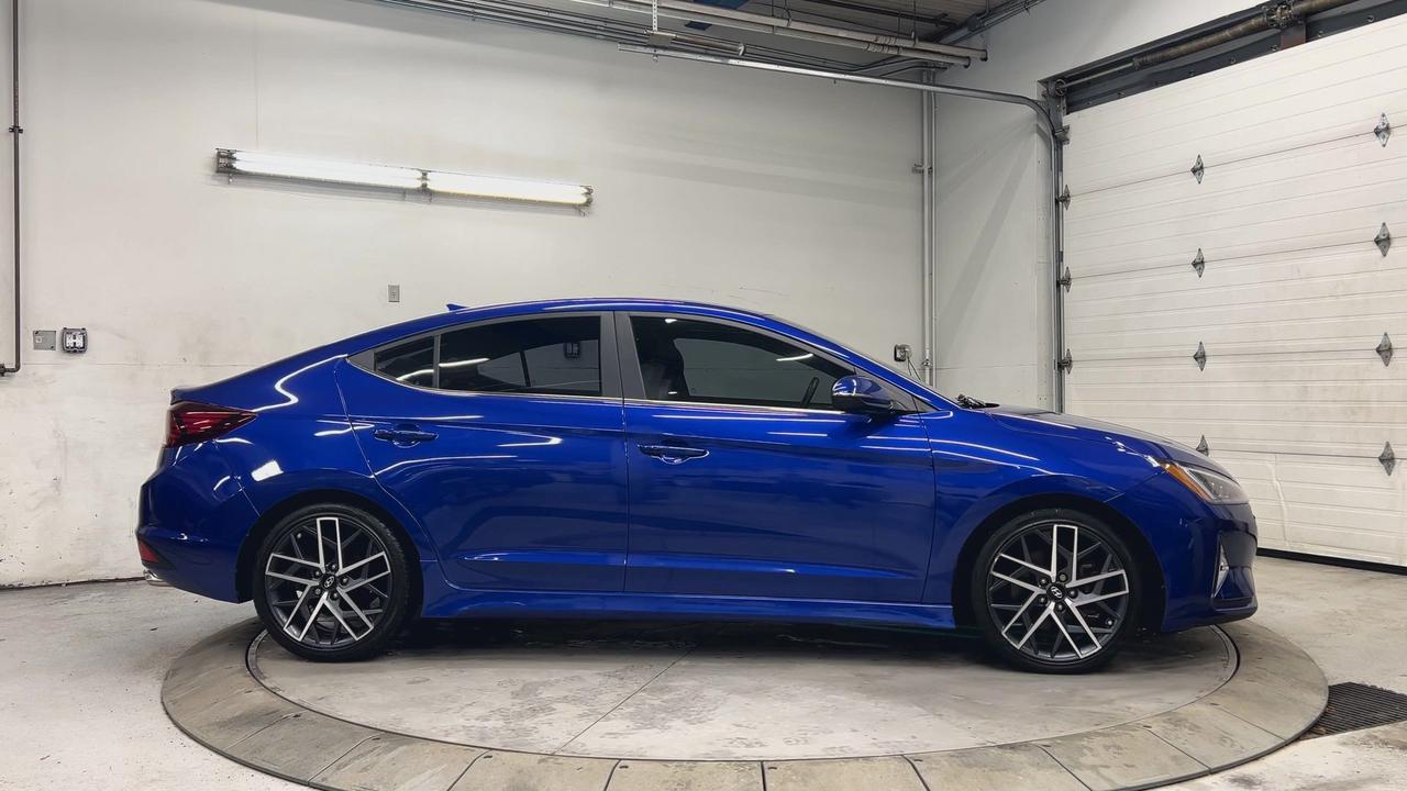 2020 Hyundai Elantra SPORT | ONLY 41,000KMS! | 201HP TURBO | LEATHER Photo
