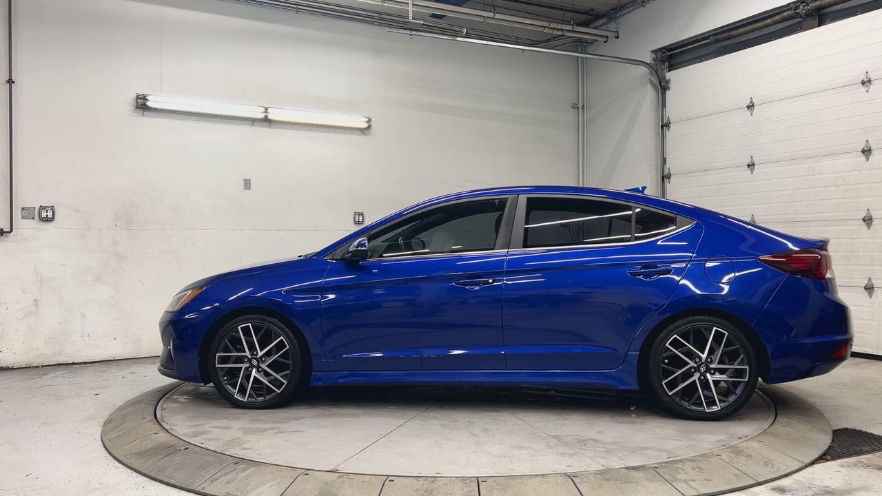 2020 Hyundai Elantra SPORT | ONLY 41,000KMS! | 201HP TURBO | LEATHER Photo