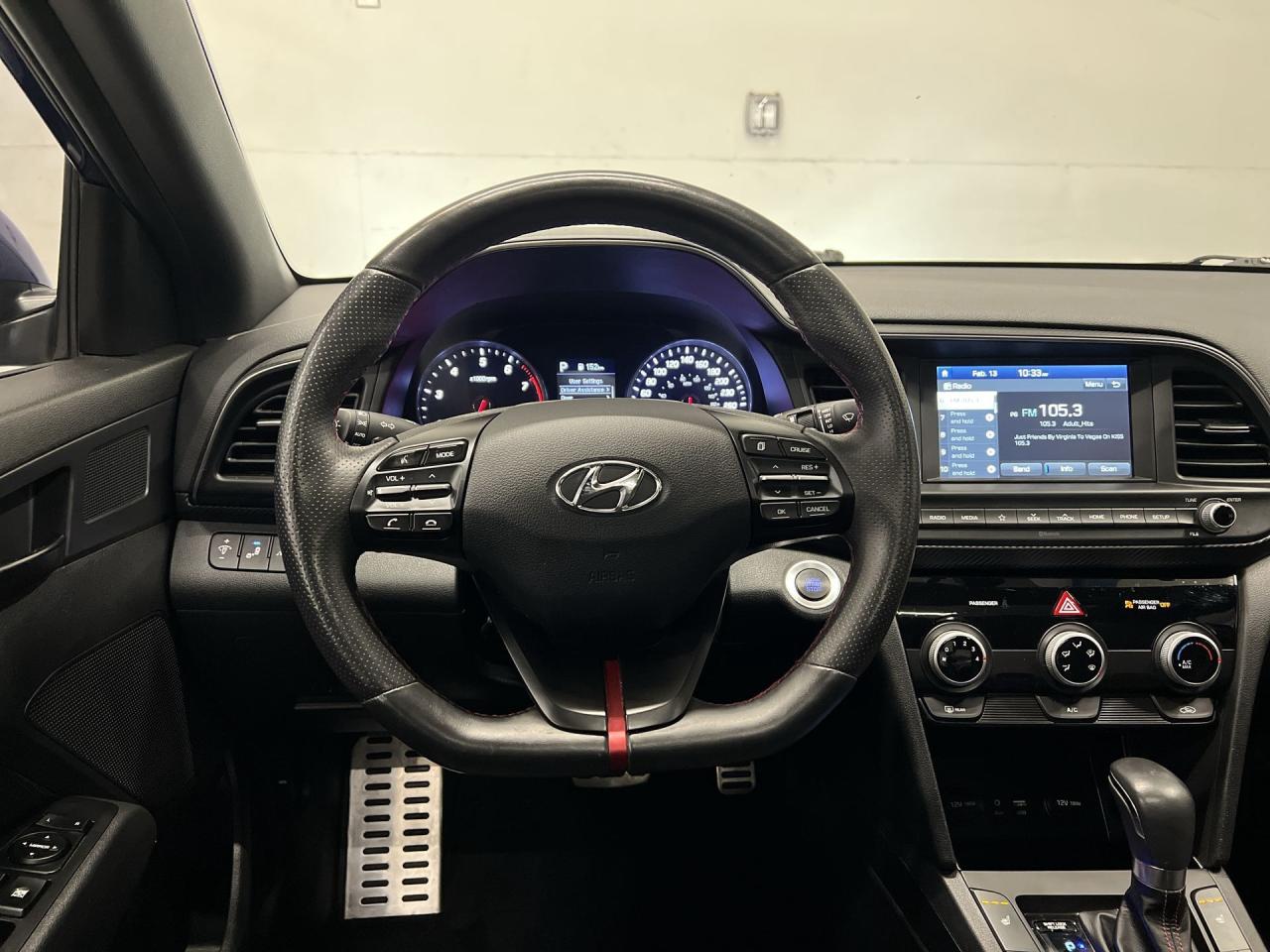 2020 Hyundai Elantra SPORT | ONLY 41,000KMS! | 201HP TURBO | LEATHER Photo