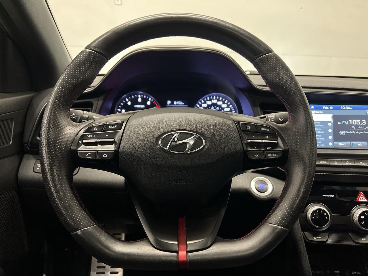 2020 Hyundai Elantra SPORT | ONLY 41,000KMS! | 201HP TURBO | LEATHER Photo