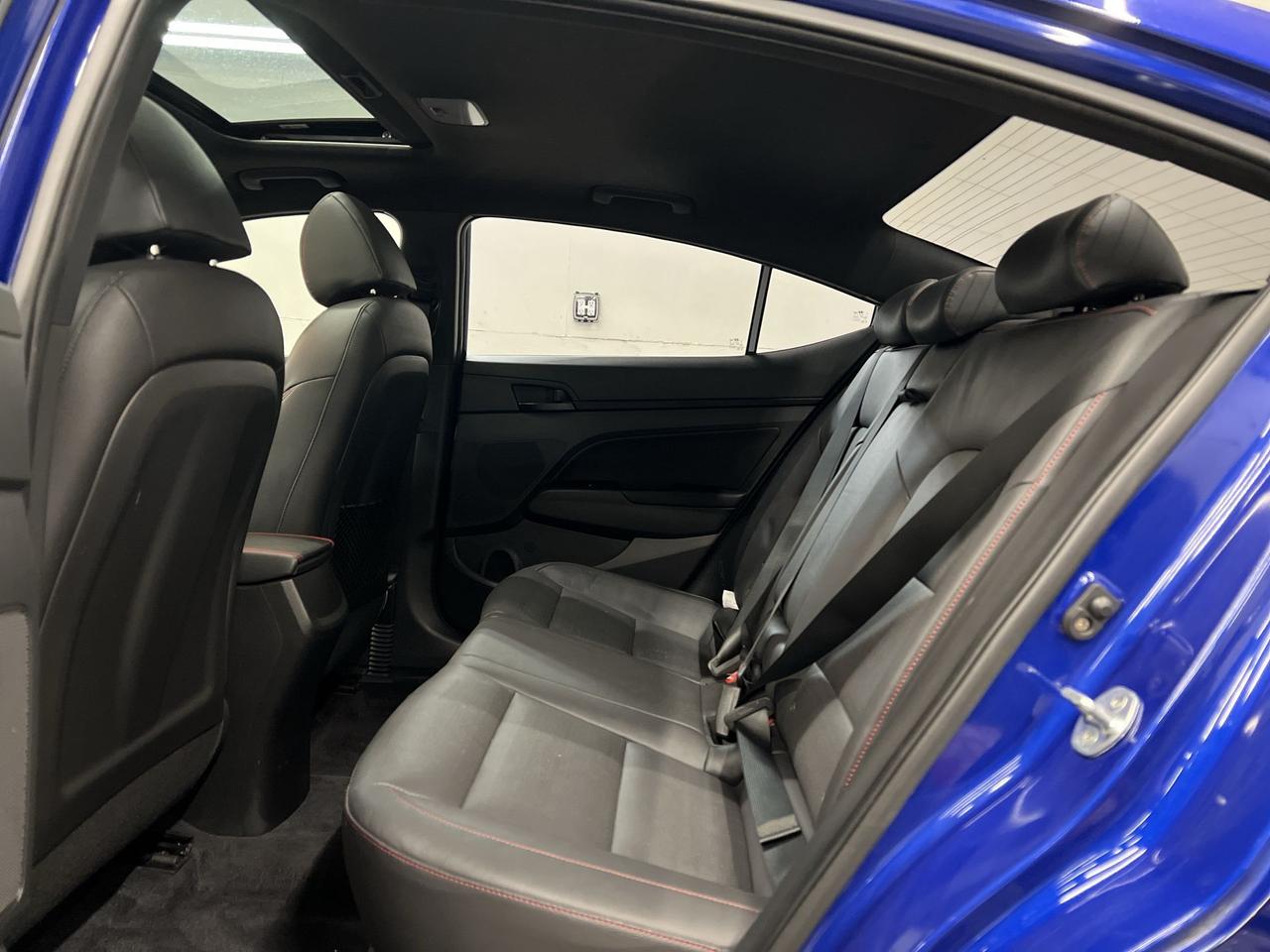 2020 Hyundai Elantra SPORT | ONLY 41,000KMS! | 201HP TURBO | LEATHER Photo