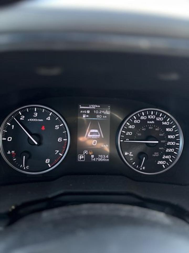 13558658