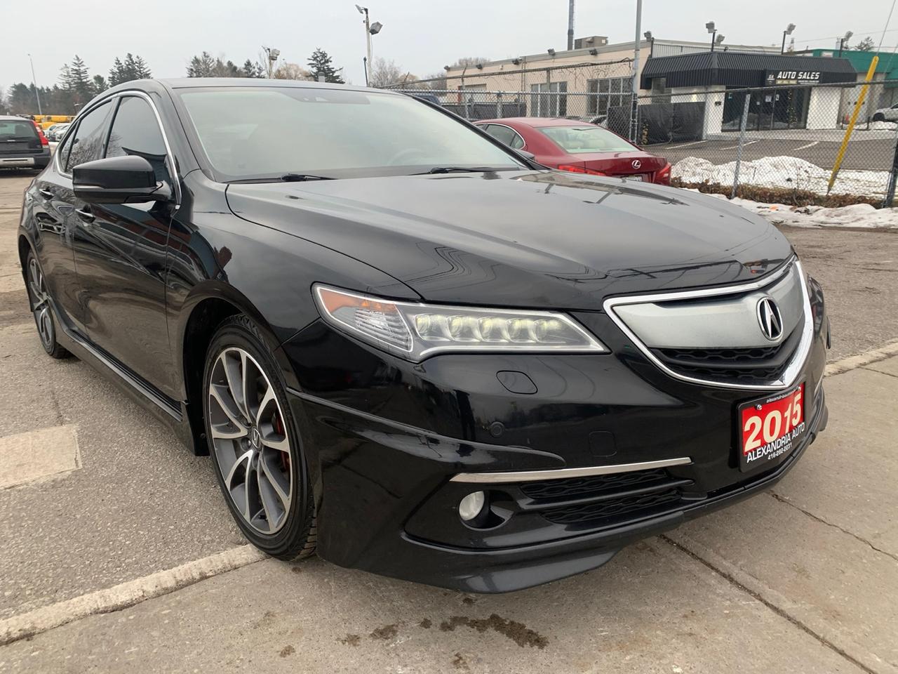 2015 Acura TLX ELITE V6 AT SH-AWD w/Advance Package Photo