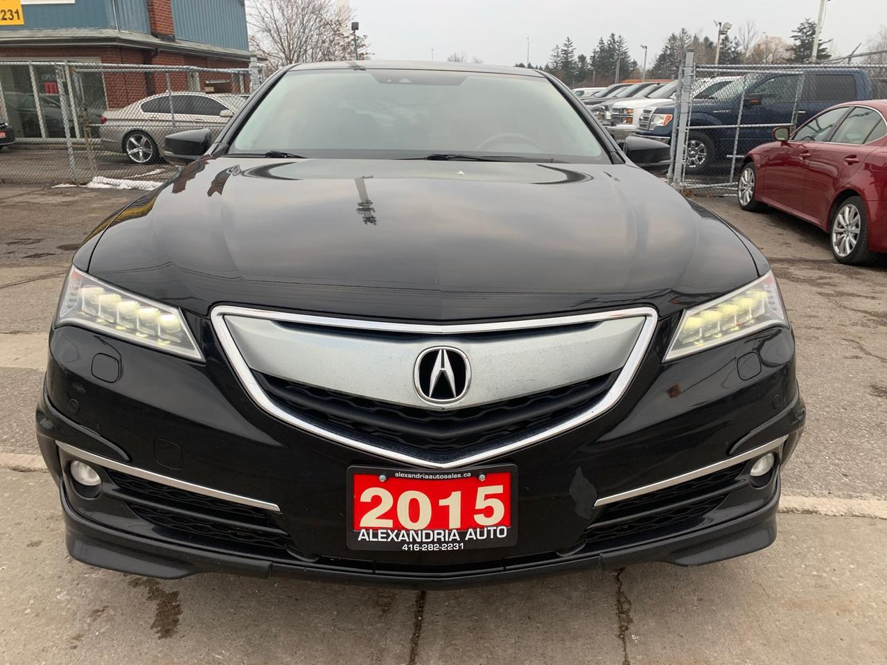 2015 Acura TLX ELITE V6 AT SH-AWD w/Advance Package Photo