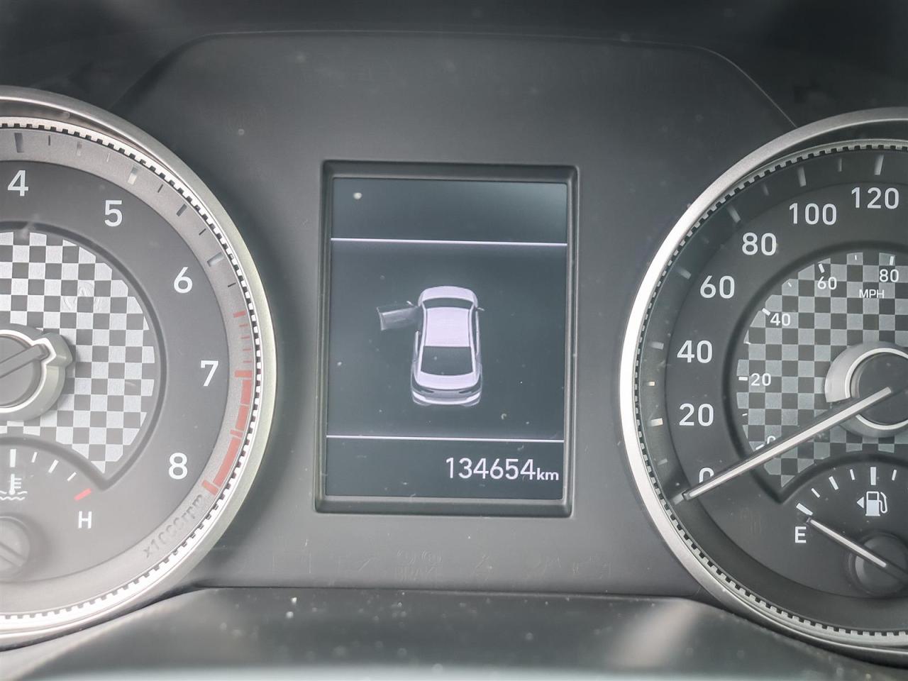 2020 Hyundai Elantra  Photo