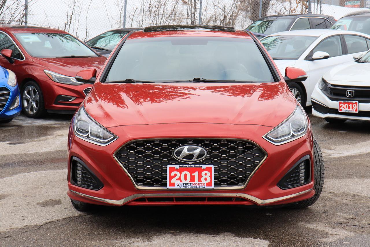 2018 Hyundai Sonata Sport | Leather | Sunroof | CarPlay | Reverse Cam Photo