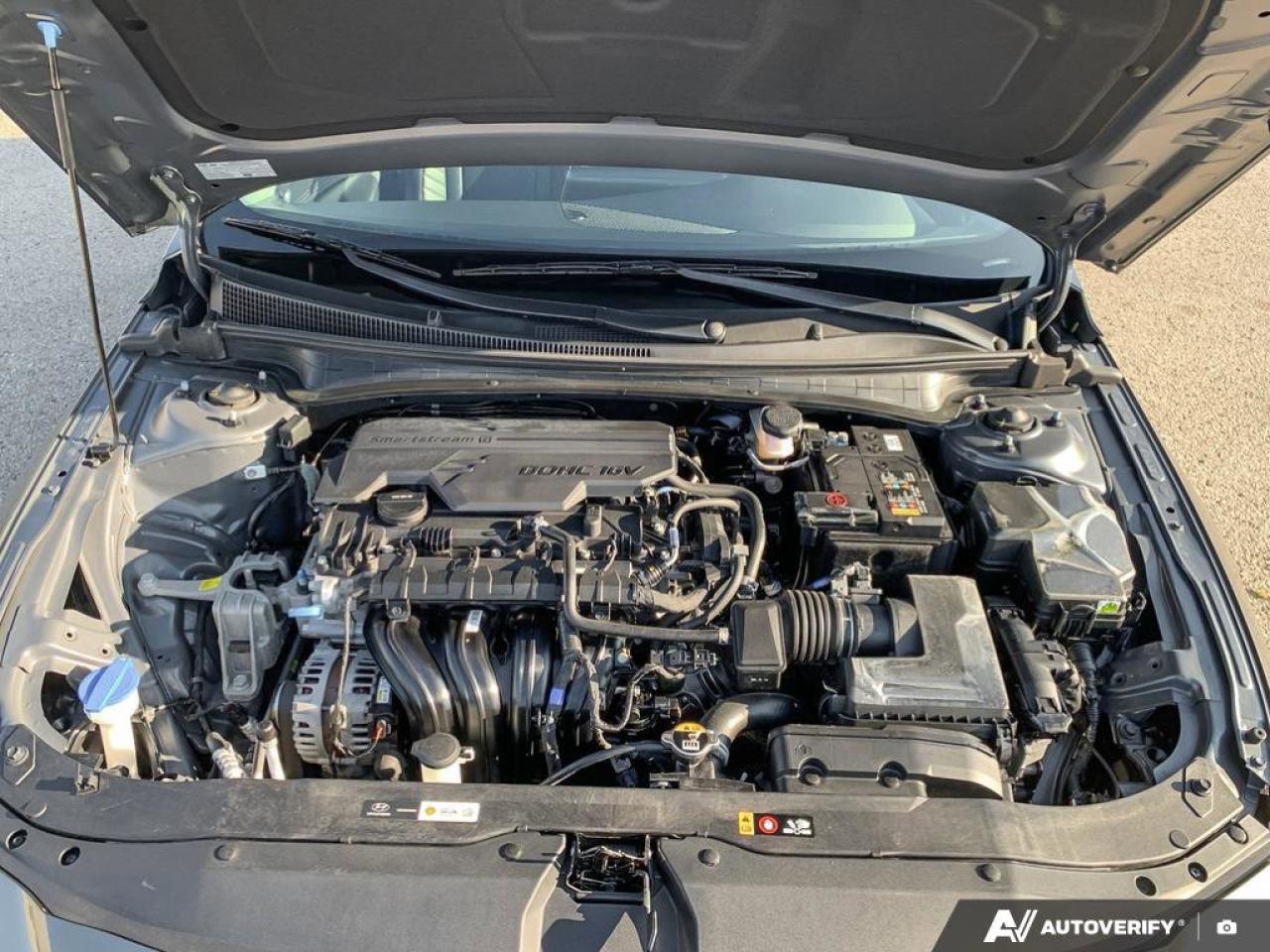 2025 Hyundai Elantra Luxury | Leather | Nav | Sunroof | Safety Tech | Photo